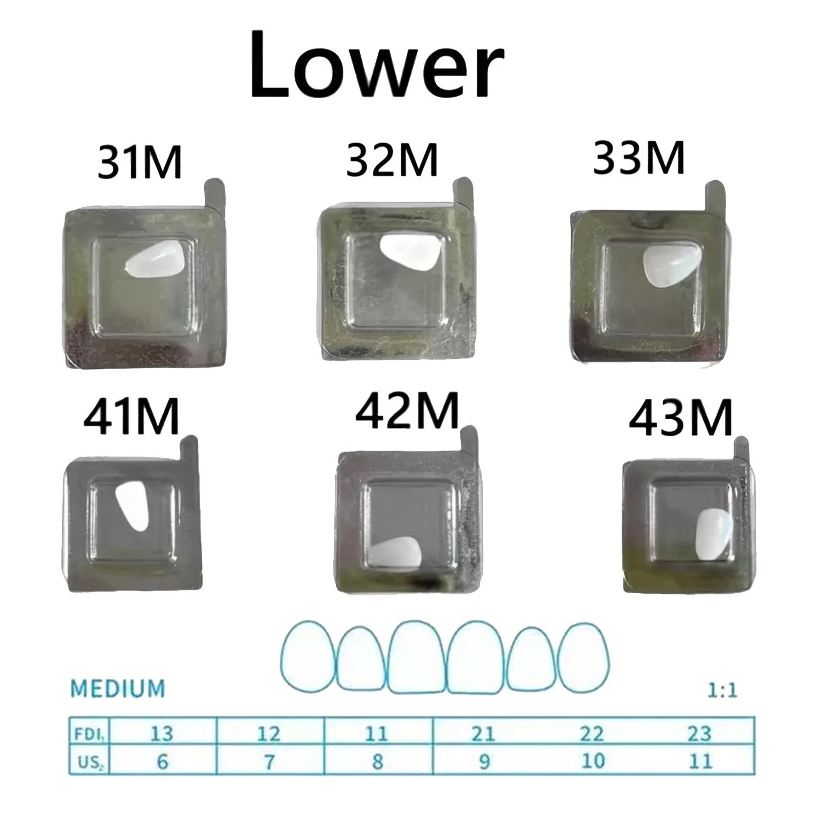 Dental Composite Upper/Lower Resin Light Cure Anterior Teeth Front Teeth Veneers