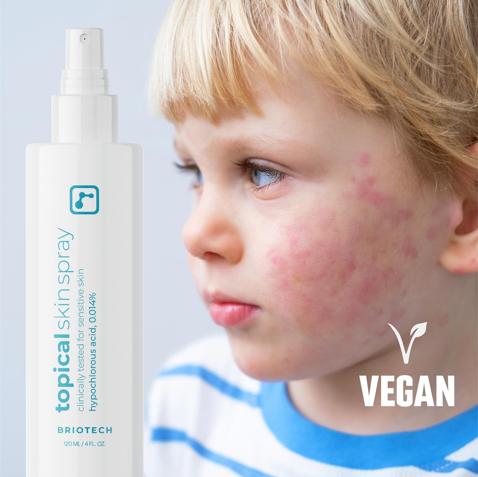 Briotech Topical Skin Spray Hypochlorous Acid Spray For Sensitive Skin Hocl