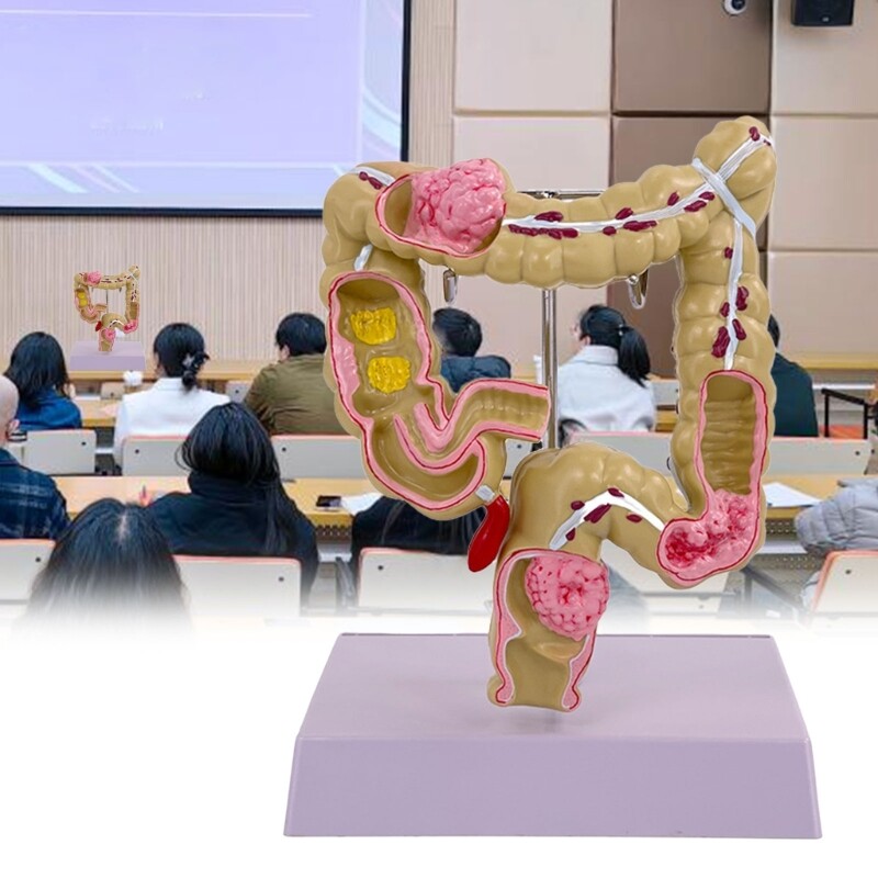 Human Large Intestine Model Teaching Model Medicals Supplies for School Study