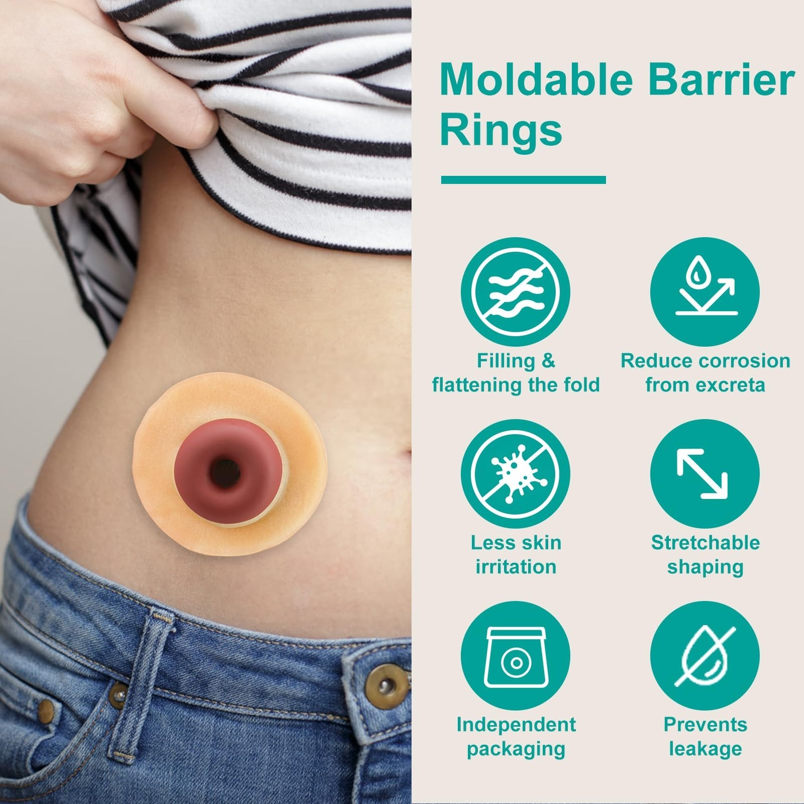 Ostomy Barrier Rings – Outer Diameter 2″ (50mm) 4mm Thickness,Moldable Ostomy…