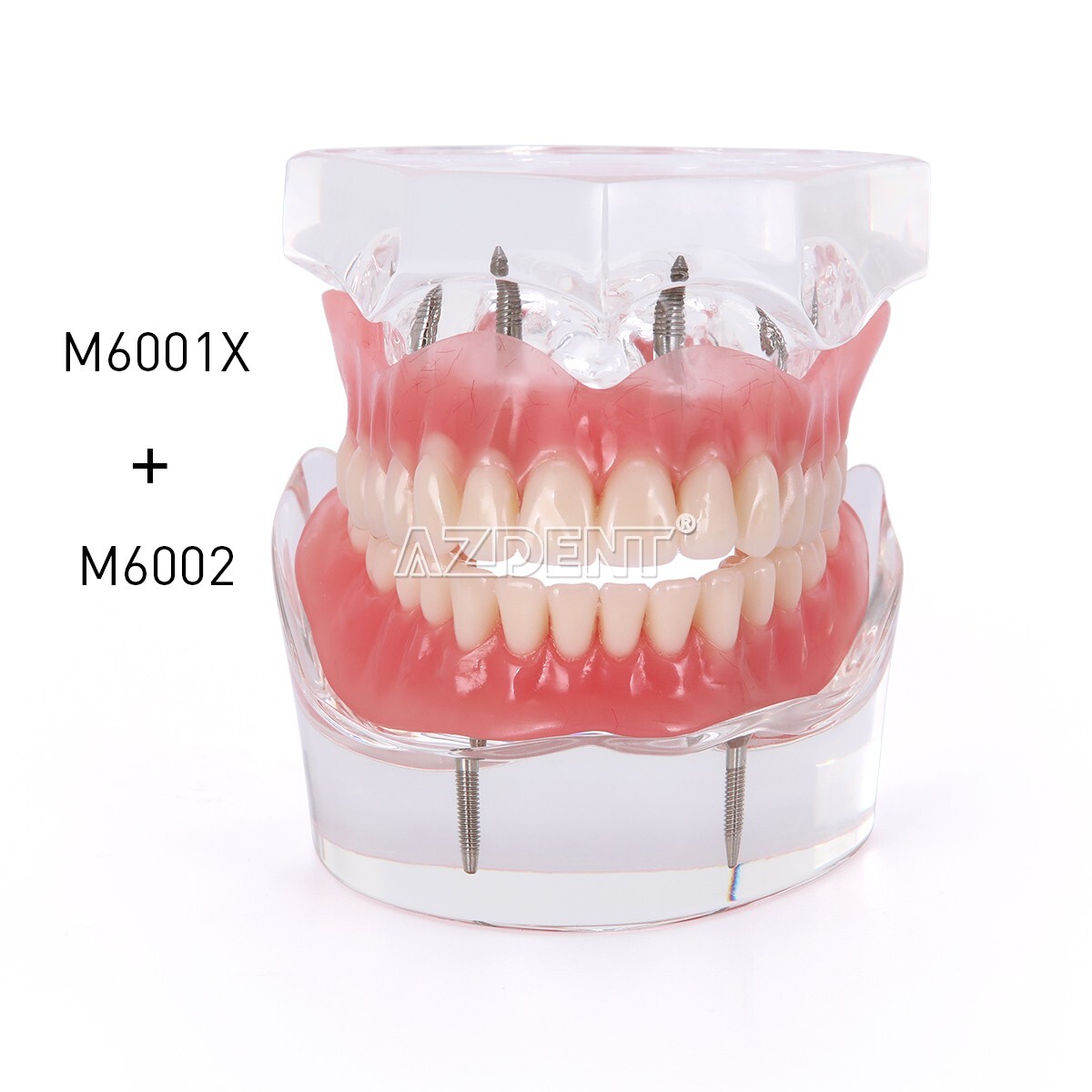 Kilgore NISSIN 200 Type Dental Typodont Model/Implant Denture Restoration Model