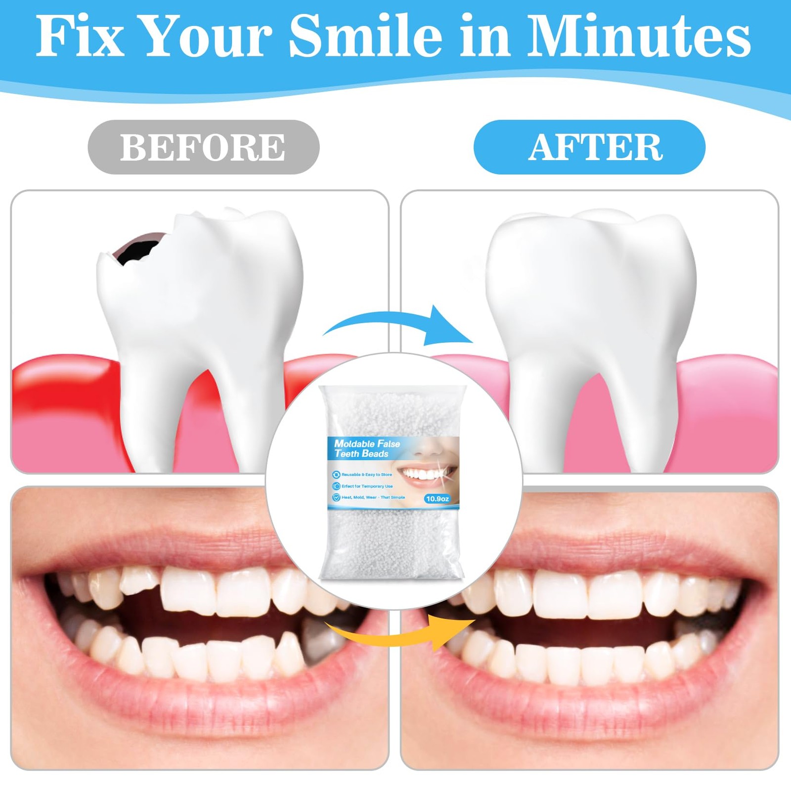RAINFLOW 10.9oz Whiten Fitting Beads – Teeth Whitening 0.04 Ounce (Pack of 1)