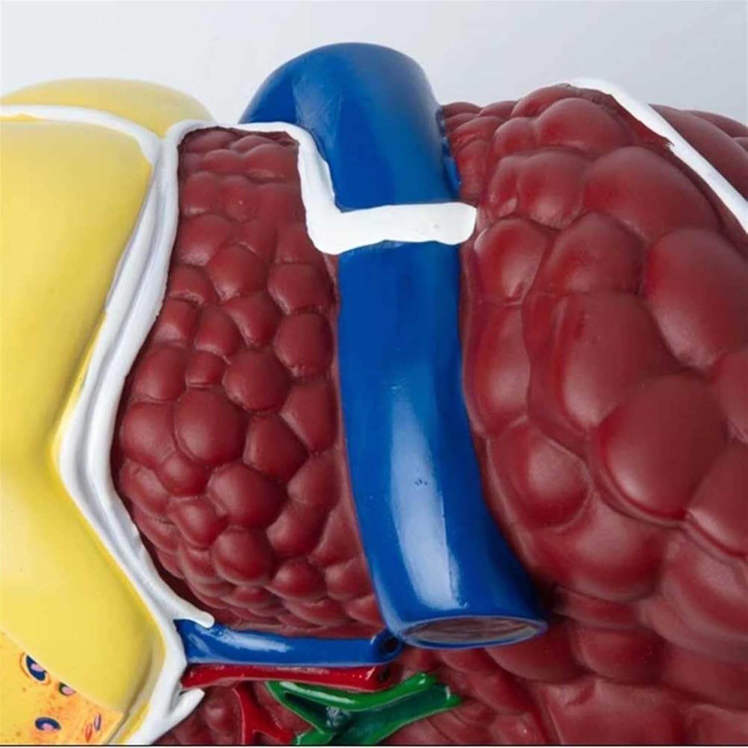 Pathological Liver Anatomical Model 1:1 Human Liver Model Anatomy Display Study