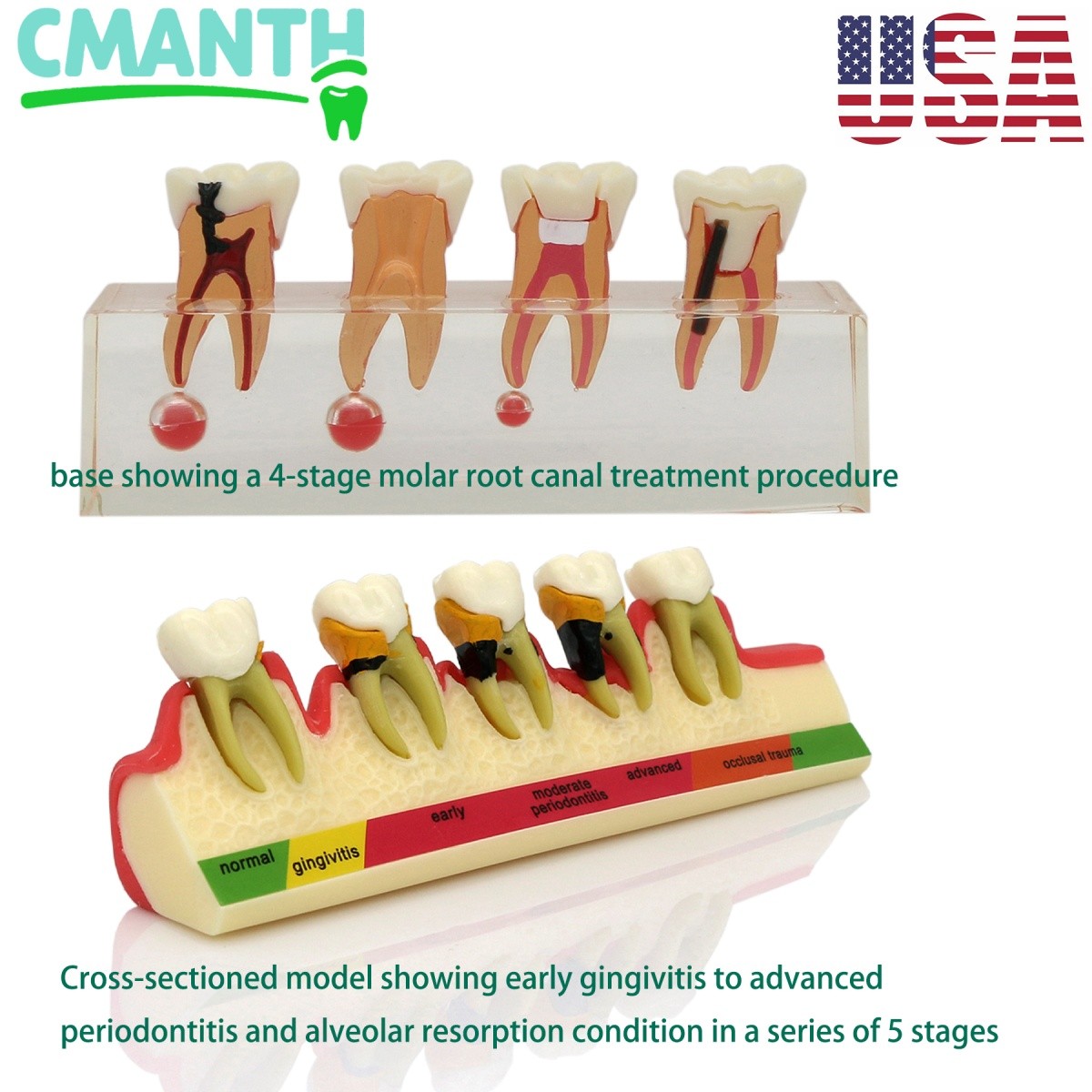 US Dental Teaching Teeth Model Implant/Perio/Disease Suture Products Demo Model