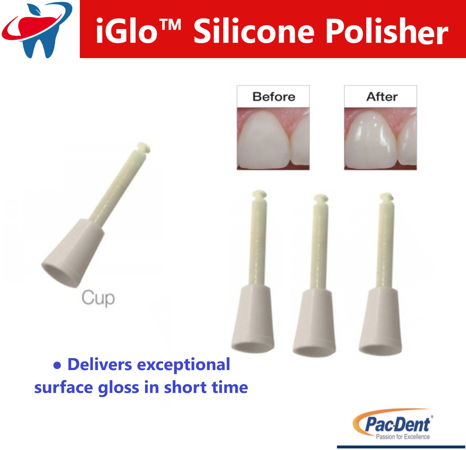 Dental Silicone Polisher Points Polishing for Composite Natural Teeth Porcelain