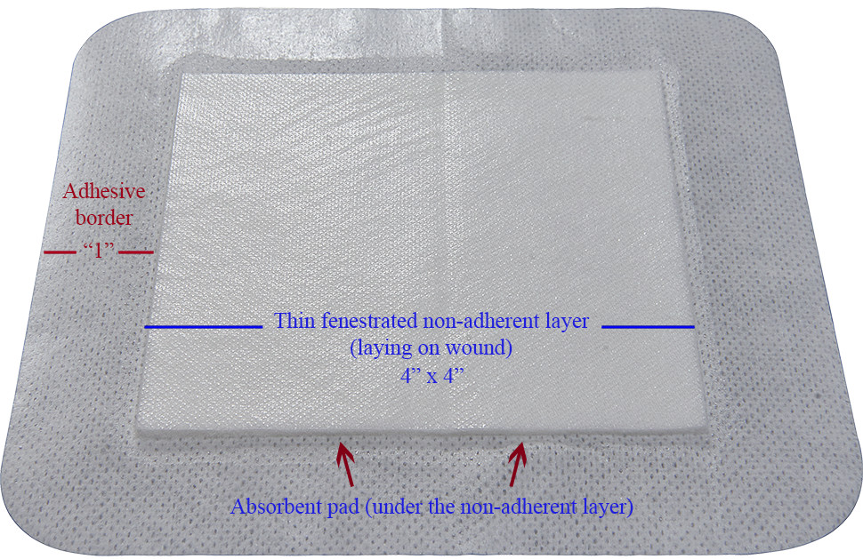 Areza Island Wound Dressing (Bordered Gauze) 6″ x 6″ Sterile (30 Per Box)