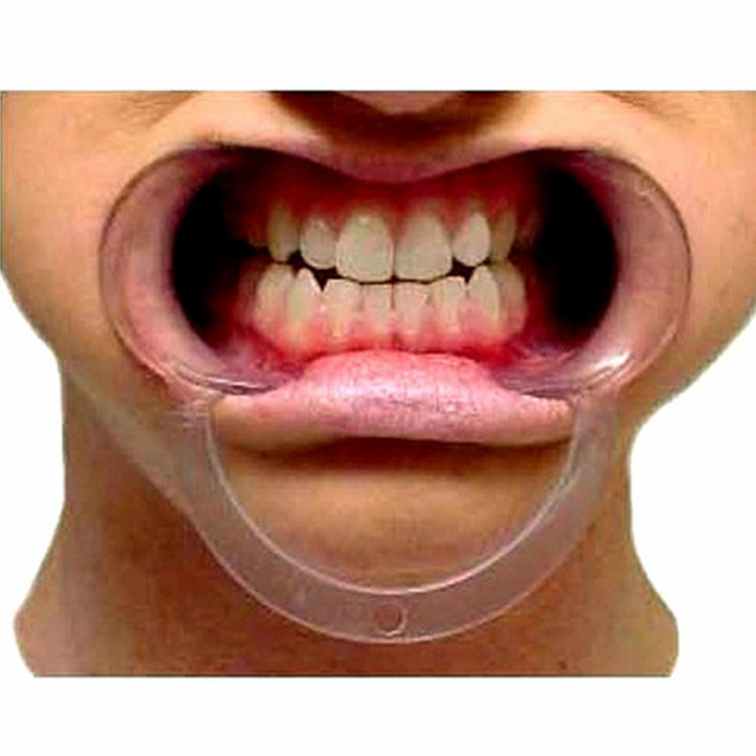 20Pc Medium Size C-Shape Mouth Opener Dental Cheek Lip Retractor Teeth Whitening
