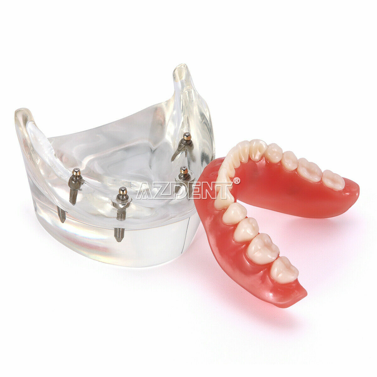 Dental Demonstration 4 Implants Teeth Model Typodont Inferior Overdenture Lower