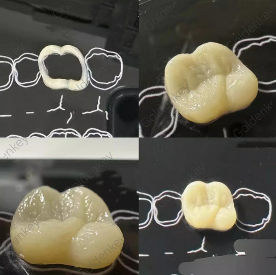 Dental Composite Filling Practise Template Board Model Student Practice Resin