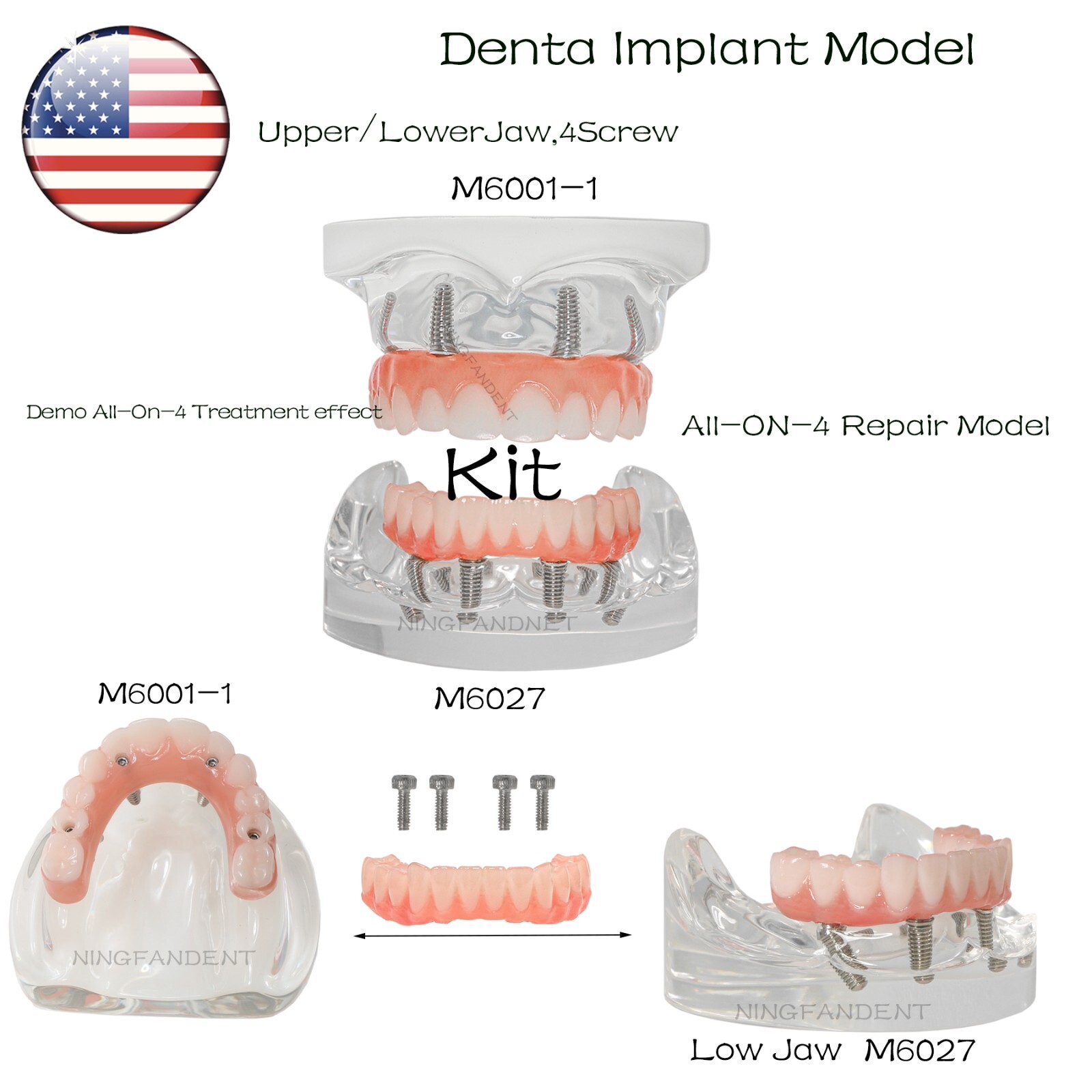 US Dental Implant Demo All-On-4 Treatment Repair Model Upper/Lower Jaw Kit,Clear