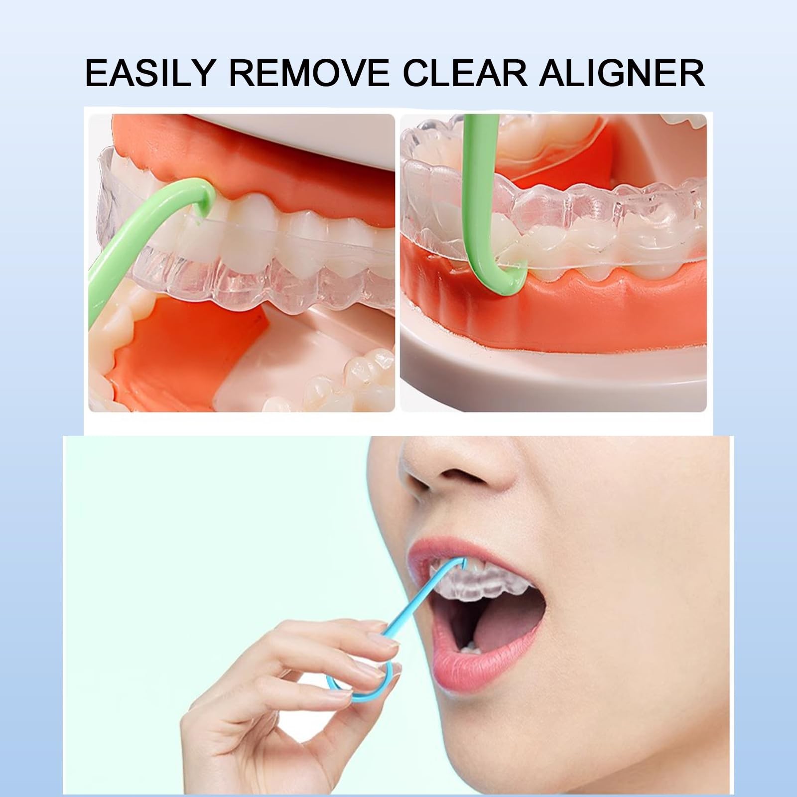 20PCS Aligner Remover Tool,5 Colors Clear Aligner Removal Tool for Invisalign…
