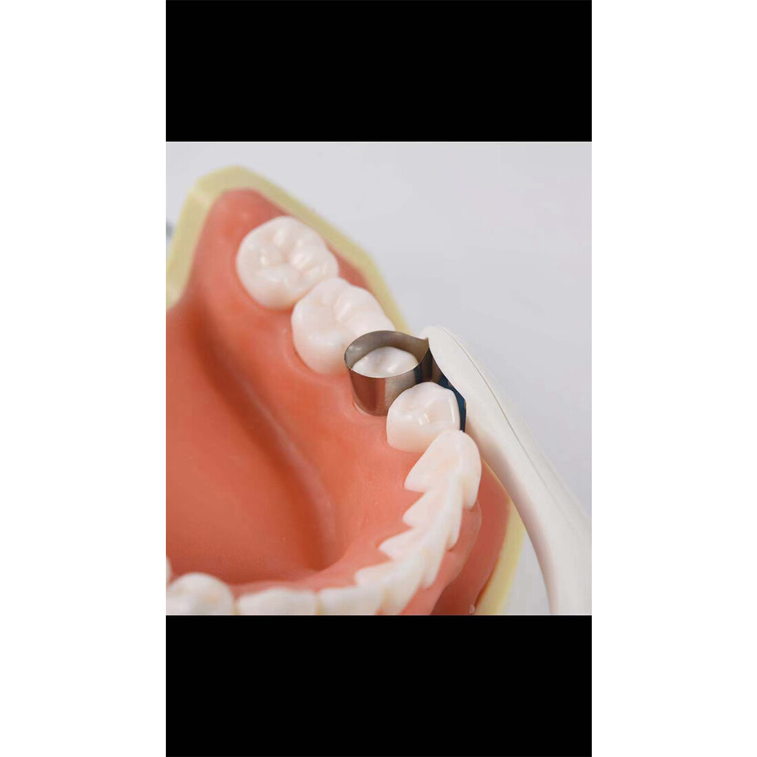 Ortho IPR Strip Dental Interproximal Reduction Kit enamel Strip+Pro Matrix Bands