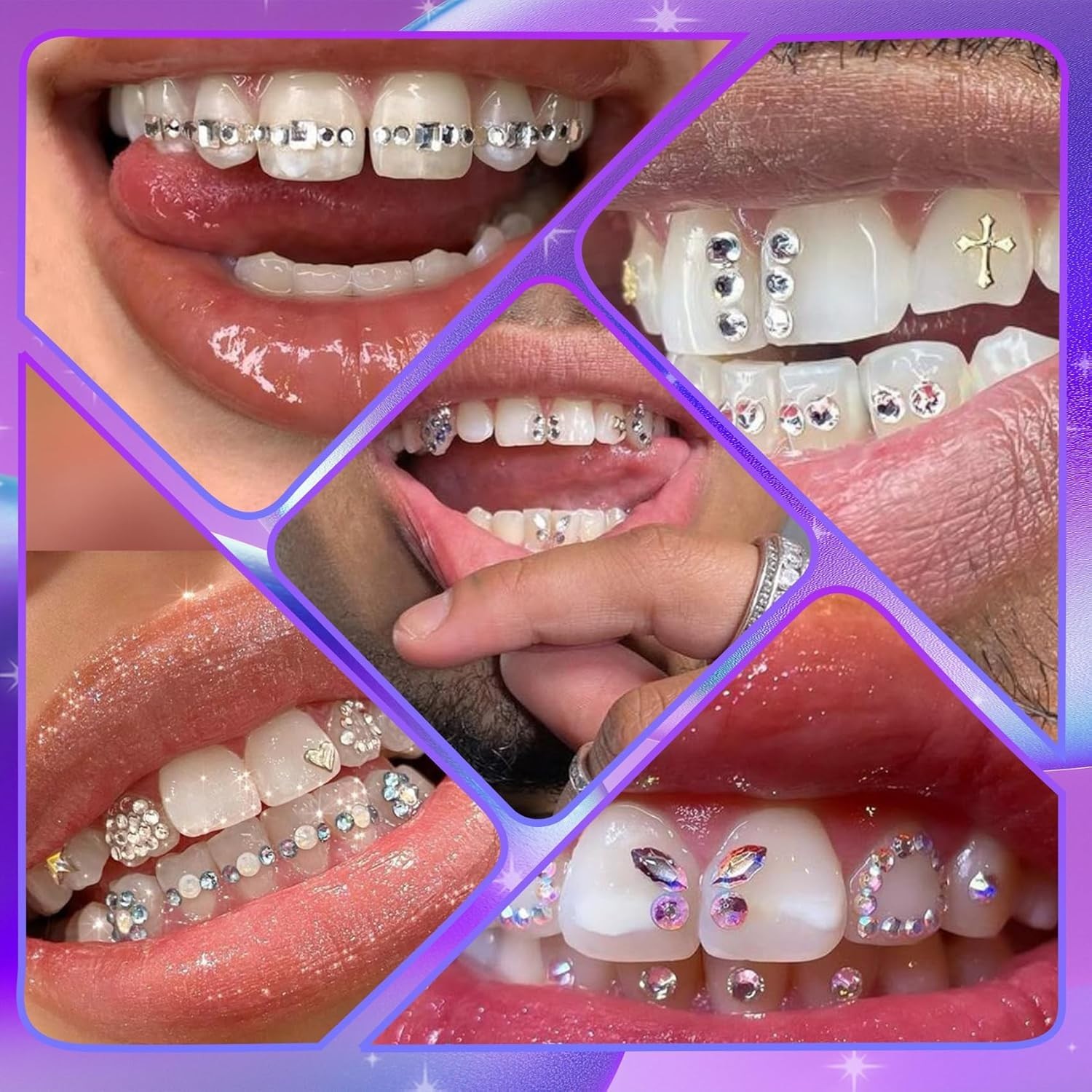 Fashionable Tooth Gem Kit – Versatile DIY Crystal Jewels for Stunning Results