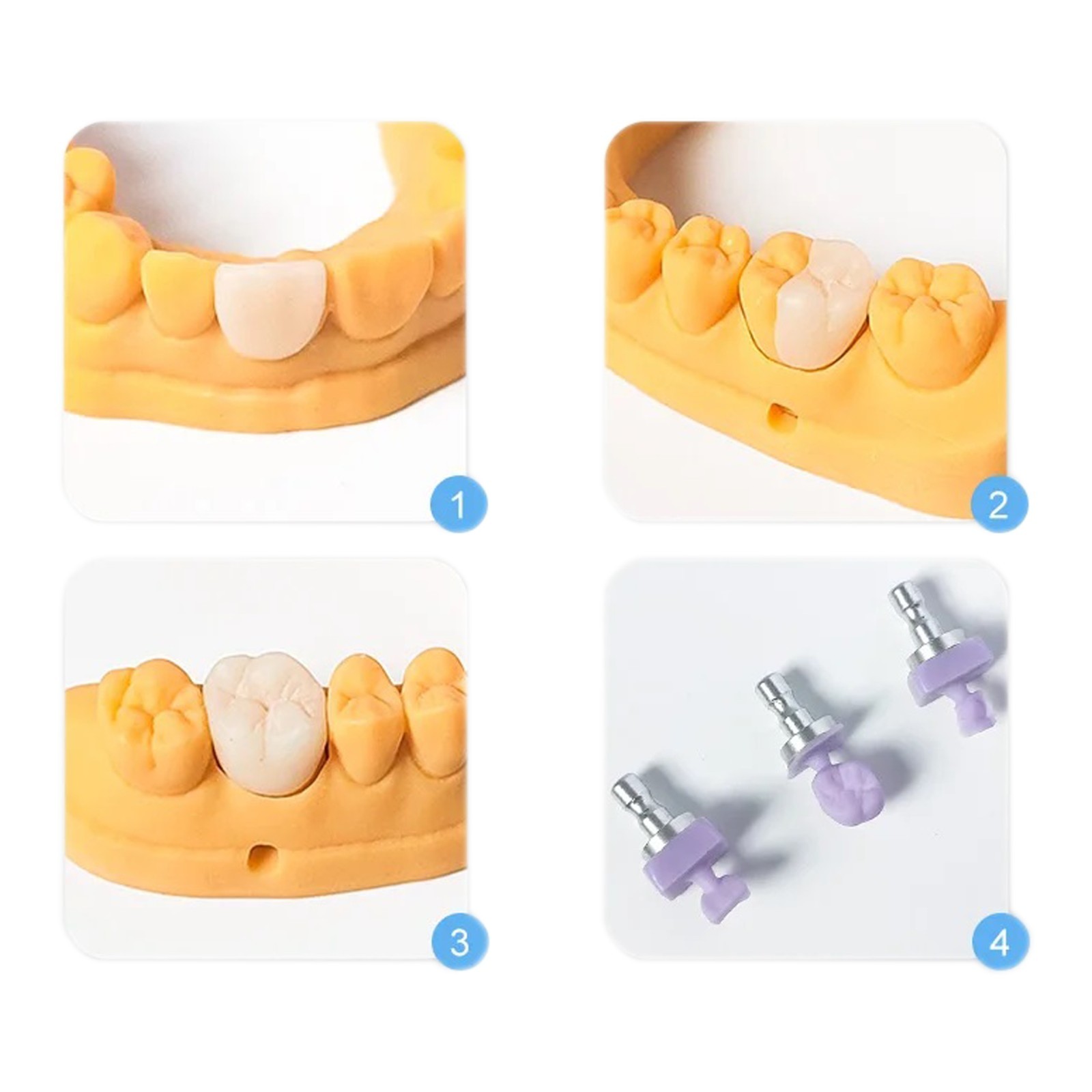 US C14 Glass Ceramic Blocks HT Lithium Disilicate CAD/CAM Cerec Blocks 5Pcs/Box