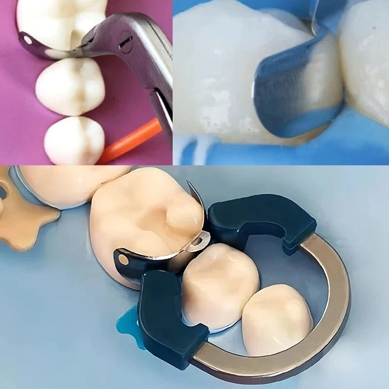 100PCS Dental C2 Matrix Bands Sectional Ring Clamp Fit Garrison Palodent V3 Set