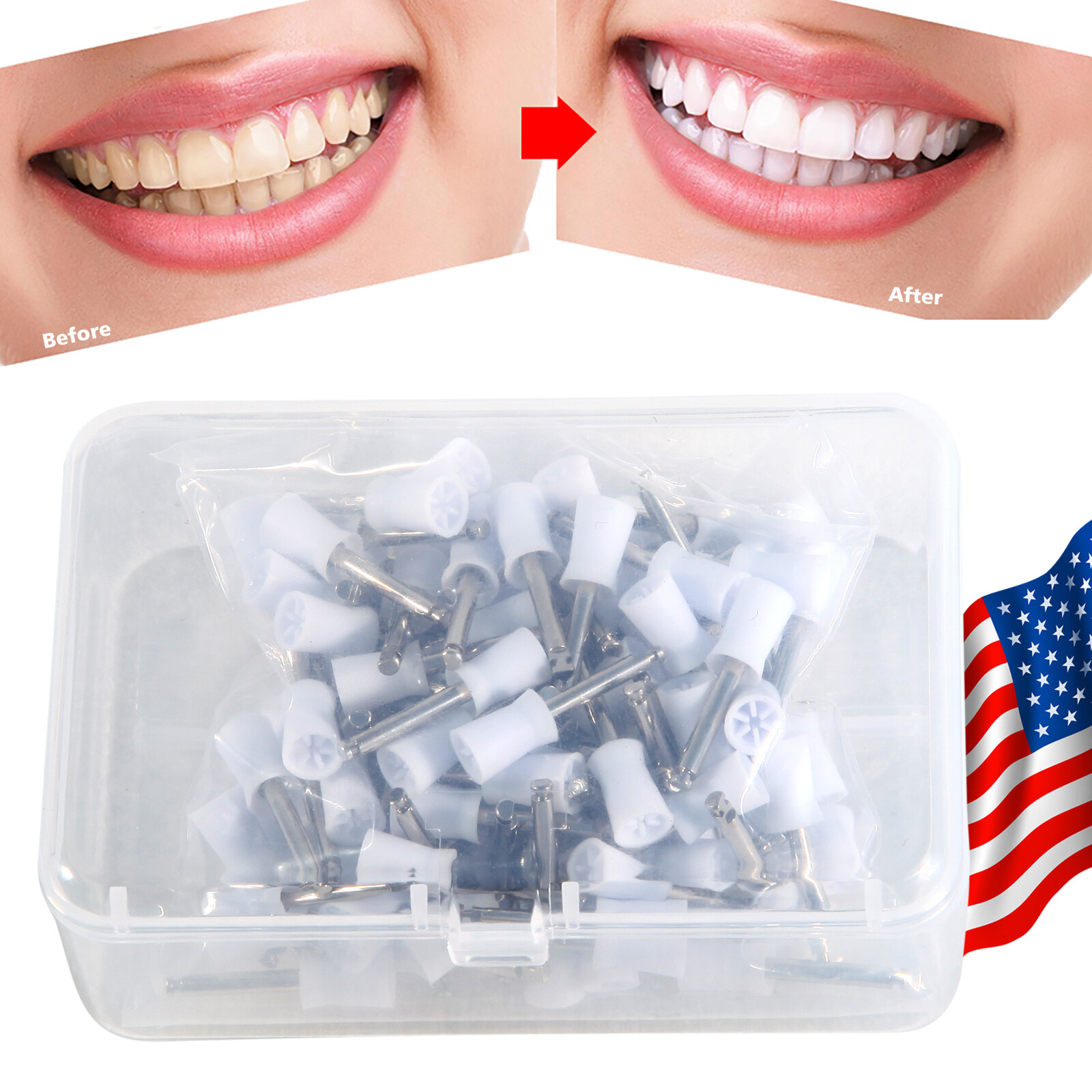 100X Dental Teeth Prophy Polishing Brushes Cups Rubber Polish Latch Green/White