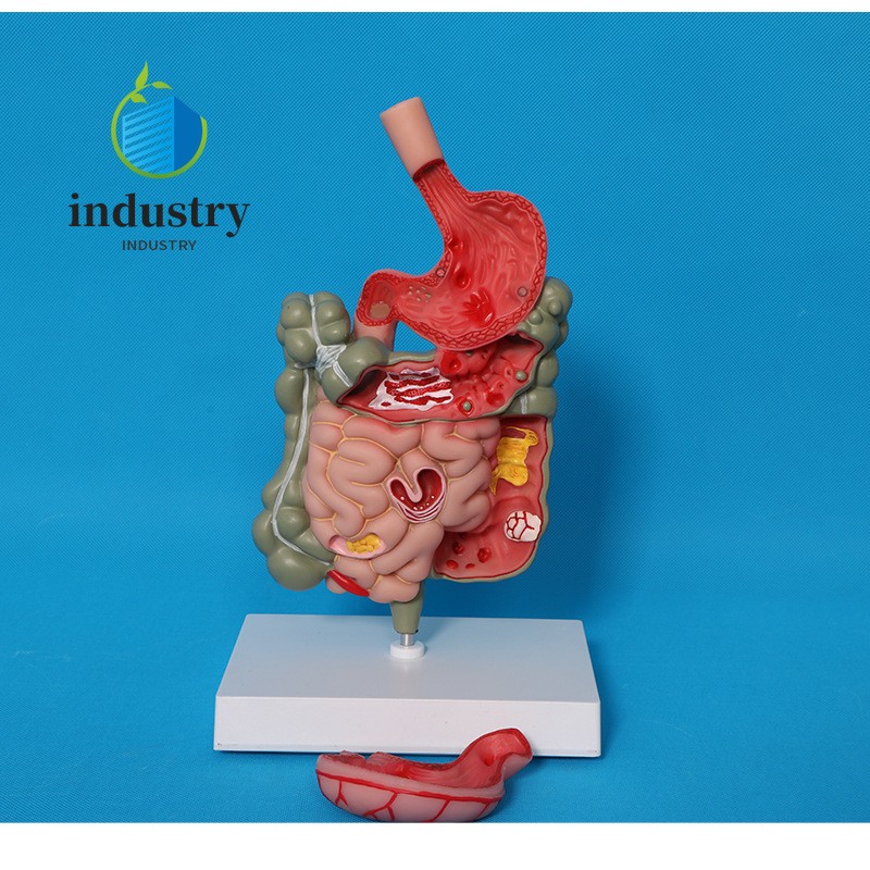 Human Digestive System Large Intestine Cecum Model Teaching Model