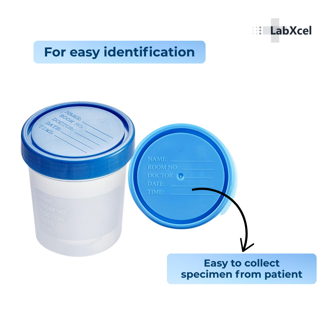 LabXcel Specimen Containers 120mL PP – Screw Cap – Sample Collection Cup 5 Pack