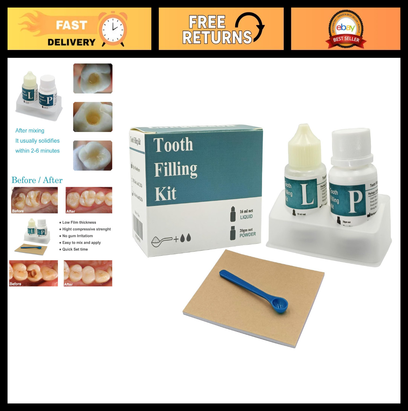 Zinc Oxide Eugenol Dental Cement Kit – Instant Tooth Repair, Crown & Bridge Fill