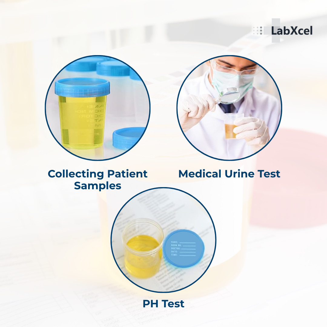 LabXcel Specimen Containers 120mL PP – Screw Cap – Sample Collection Cup 5 Pack