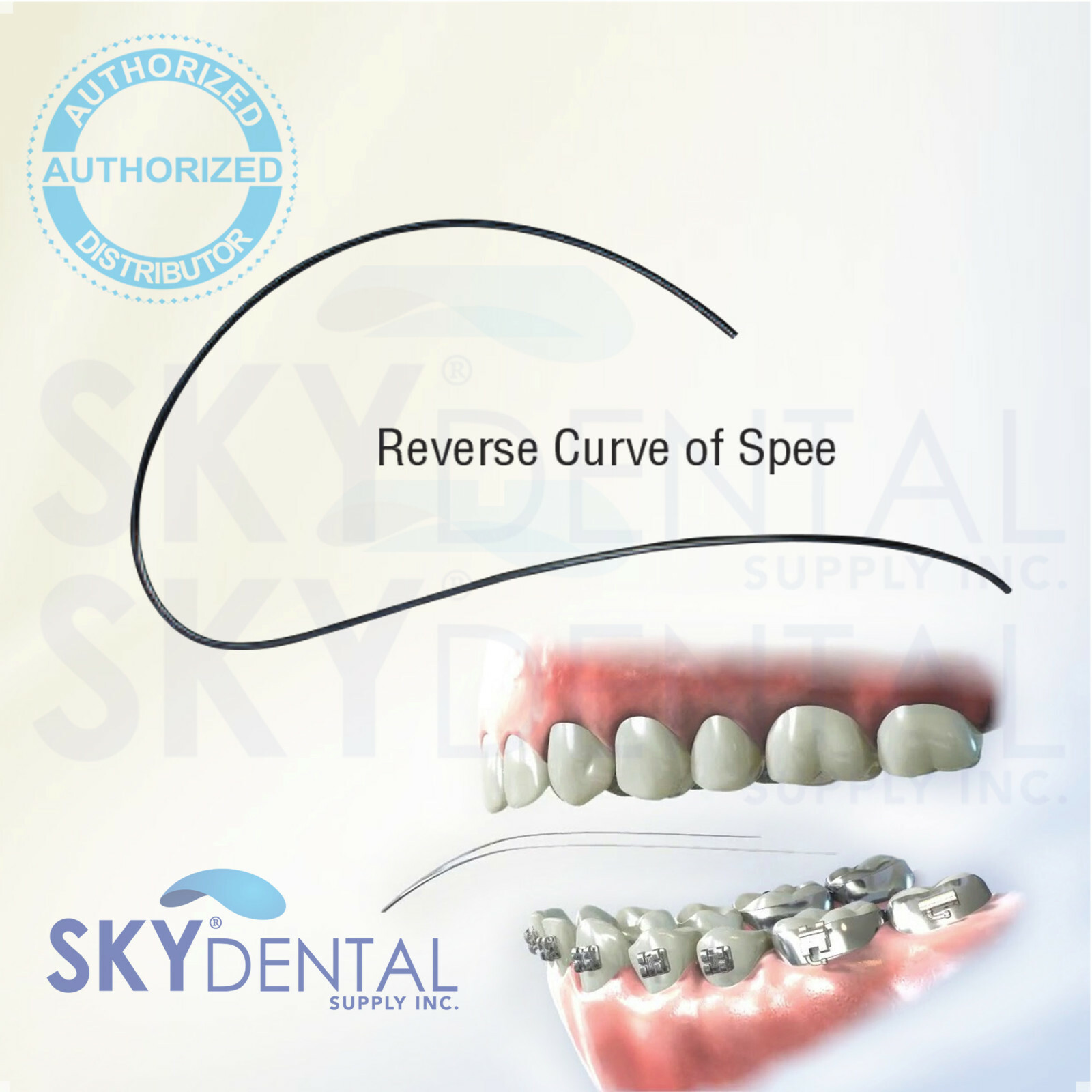 NiTi Wires RCS Reverse Curve of Spee Dental Rectangular Archwire 10/pk