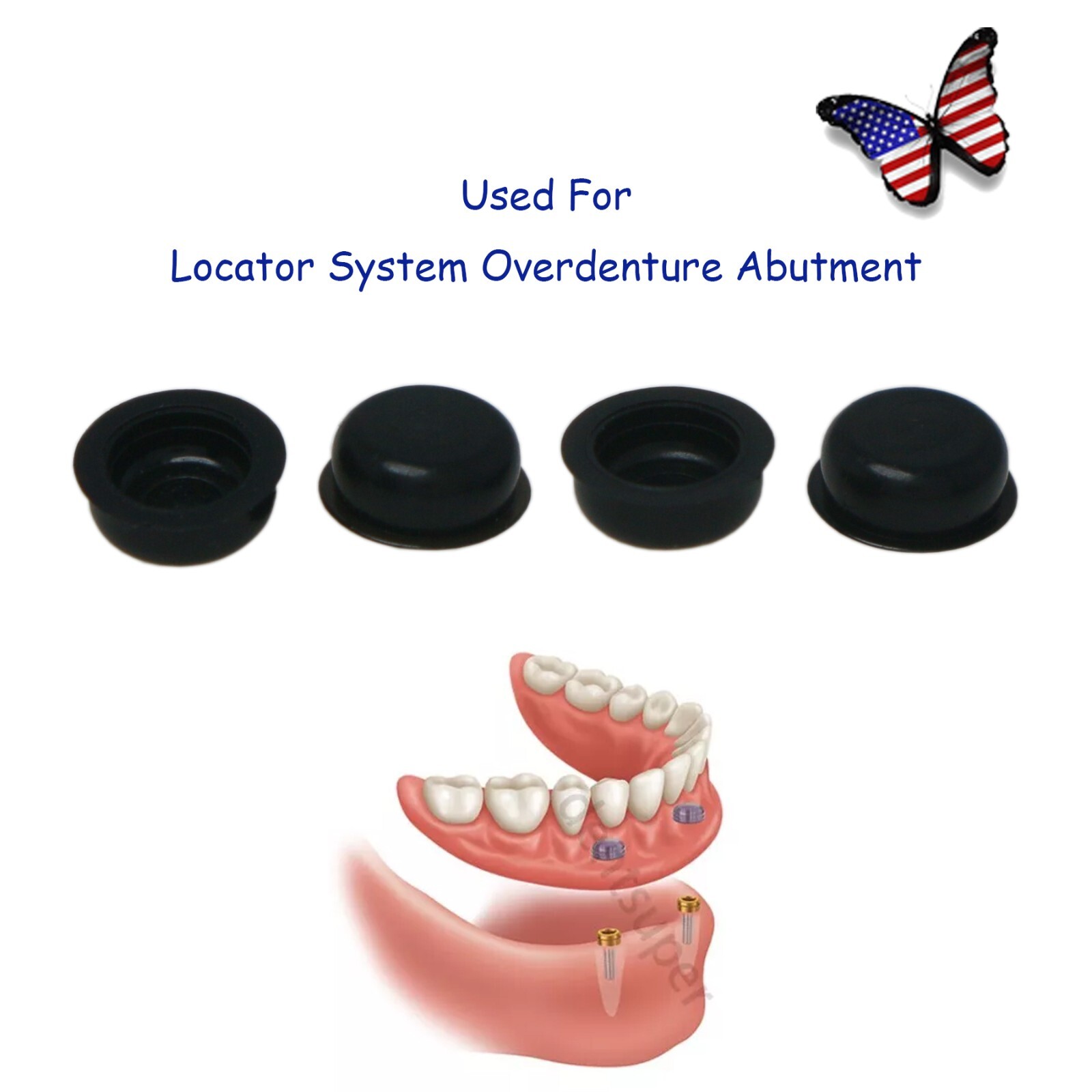 US Dental Retention Caps Lab Cap for Overdenture Locator male processing Inserts