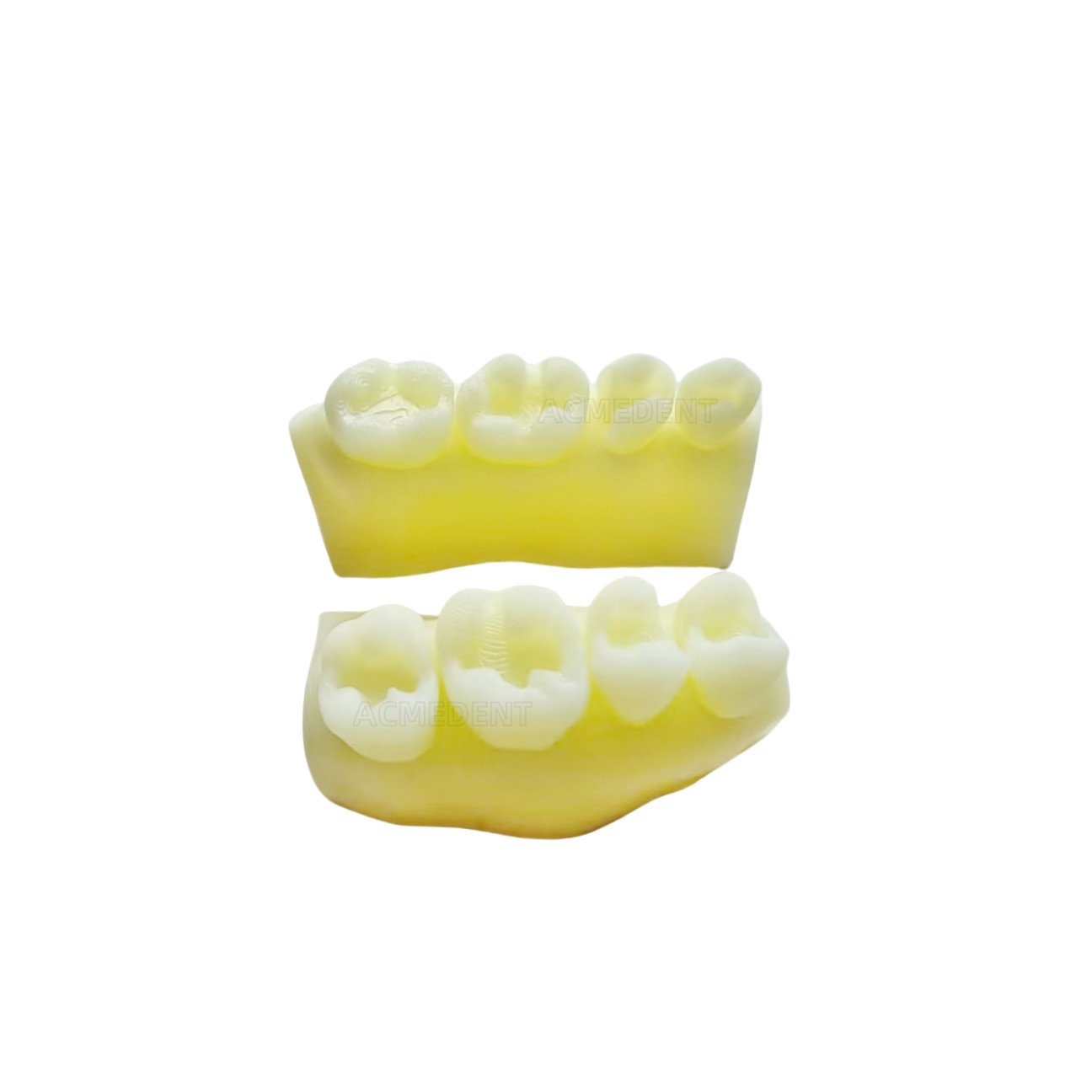 10Sets Dentist Education Sectional Matrix Daily Practice Course Composite Resin