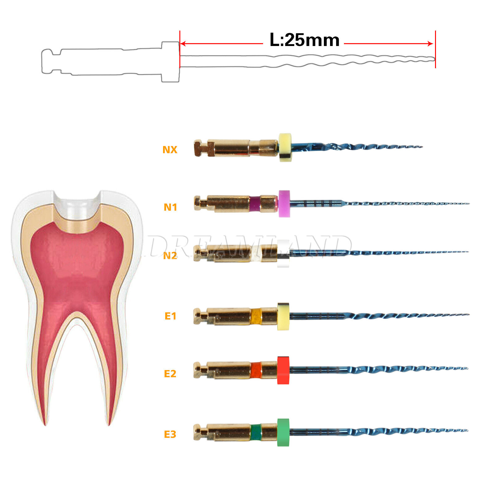 6pcs Dental NiTi Super Files Rotary Tip Endodontic Endo Motor Root Canal 25mm