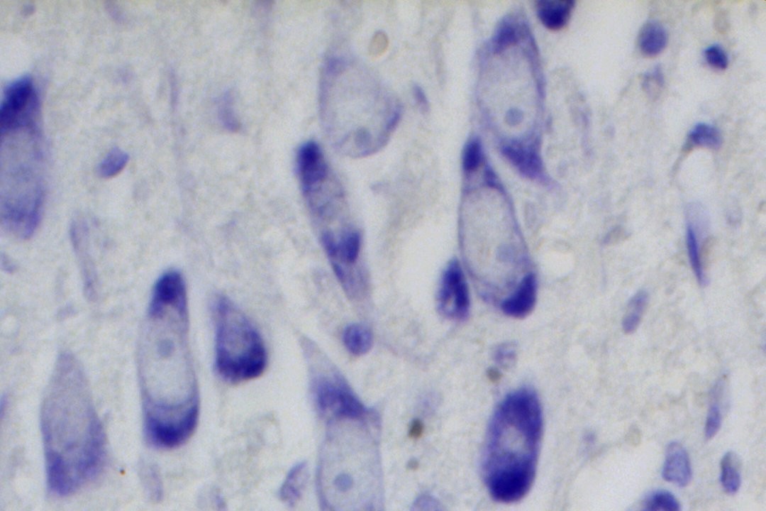 VitroView™ Nissl Stain Kit (Cat# VB-3010)