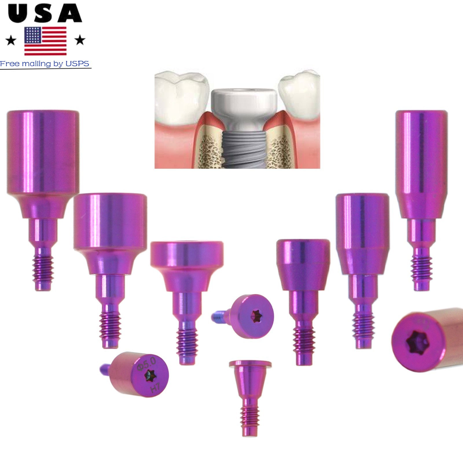 Nobel Active Compatible Healing Abutment NP RP ∅3.6 5.0 6.0 Conical Dental Caps
