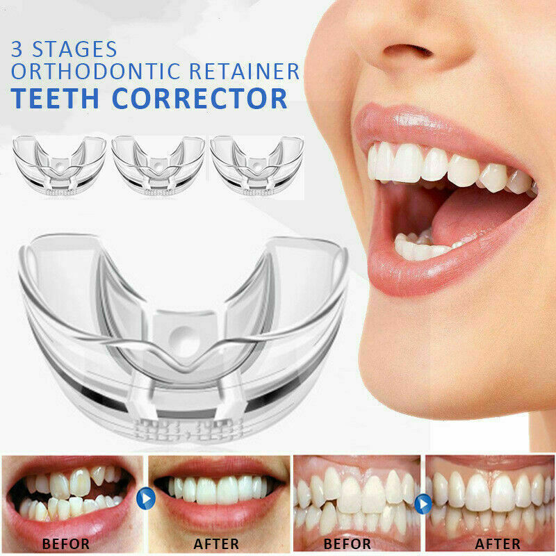 Teeth Correction Braces Tooth Retainer Straighten Dental Orthodontic x3 Stages