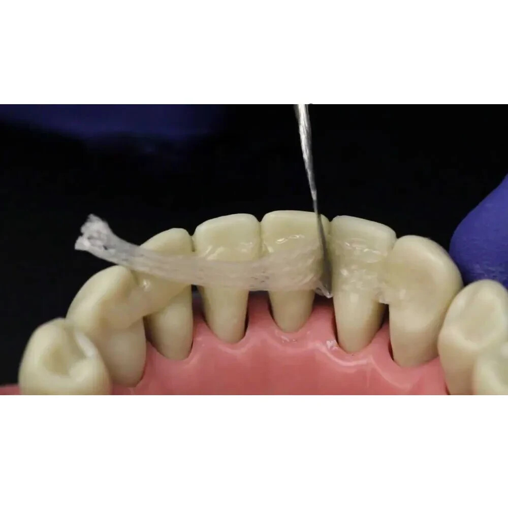 Kids-e-Dental E-Splint Esthetic fiber-reinforced