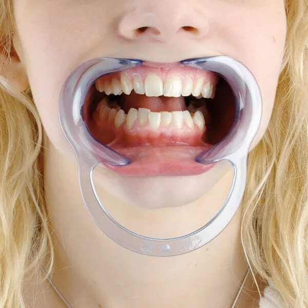 *2-Pieces* Hager Spandex Lip & Cheek Retractor Adult Clear Plastic 605454
