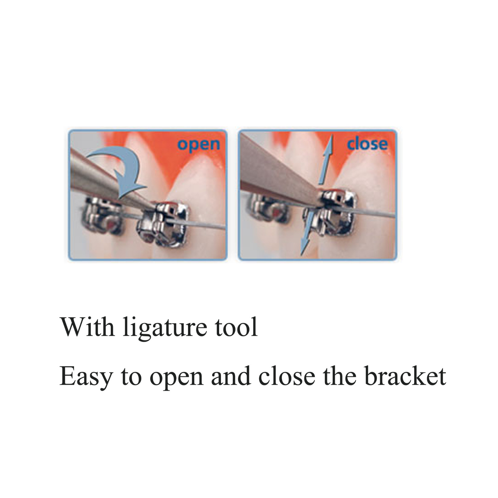 Dental Orthodontic Brackets Braces Mini Standard Roth MBT.022 Damon Q Empower