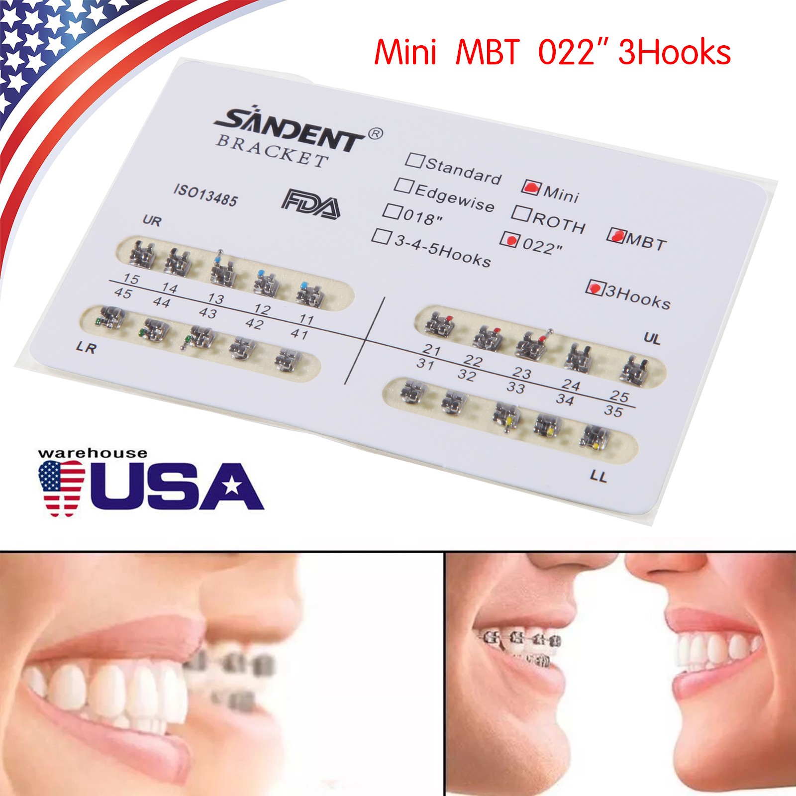 200PCS Orthodontics Dental Metal Brackets Braces Mini MBT 022Slot 3 Hooks M#4
