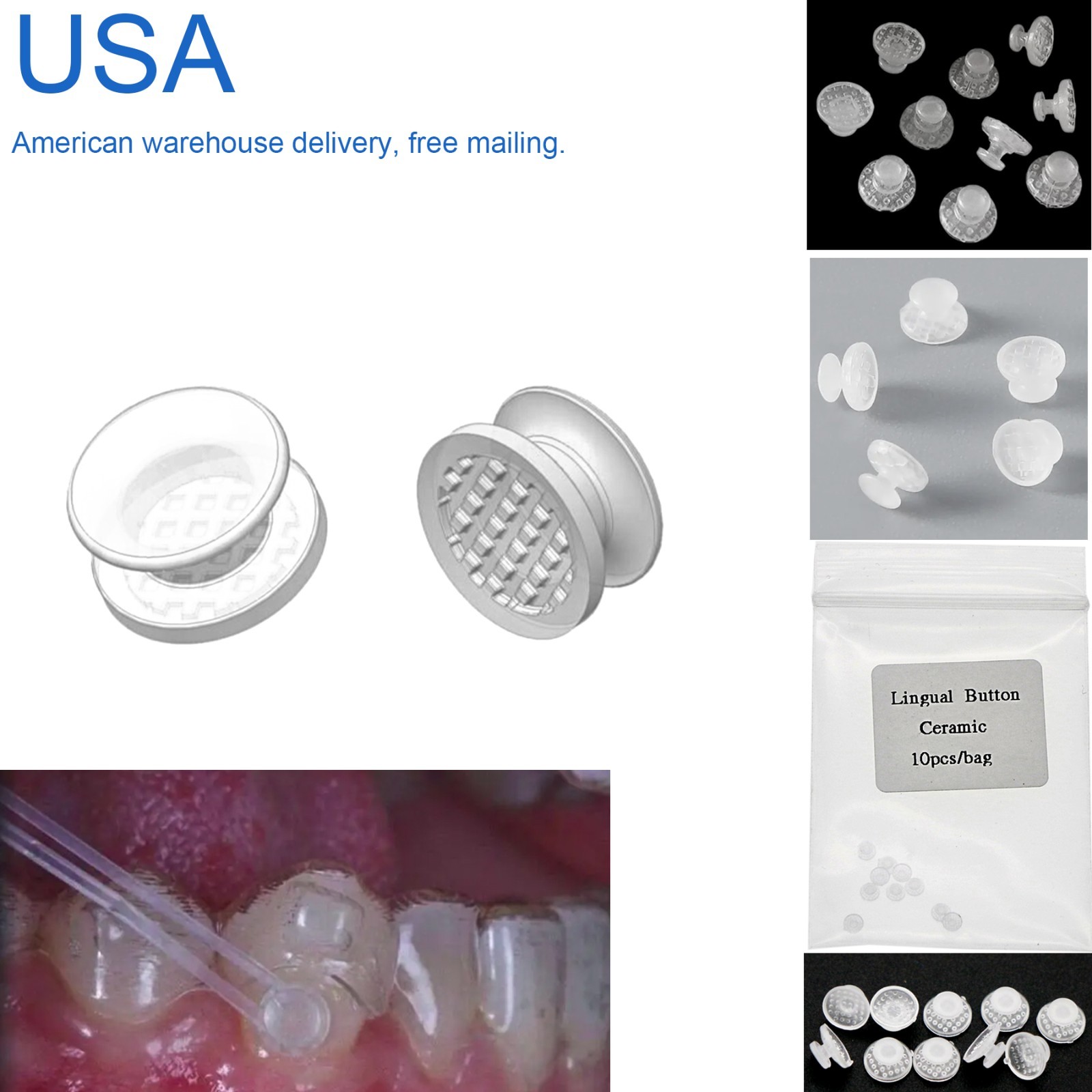 US Dental Ortho Lingual Buttons Bondable Round Mesh Base Metal/Ceramic Composite