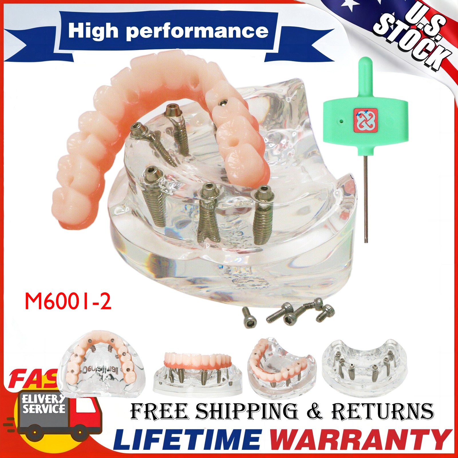 M6001-2 Dental Implant Overdenture Model All-On-6 Treatment Upper jaw 6 Screws