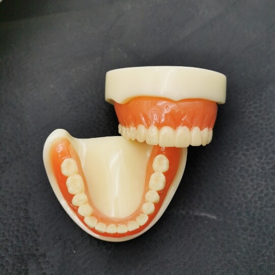 Dental 2 Implants Overdenture Typodont Restoration Upper Lower Lower Teeth Model