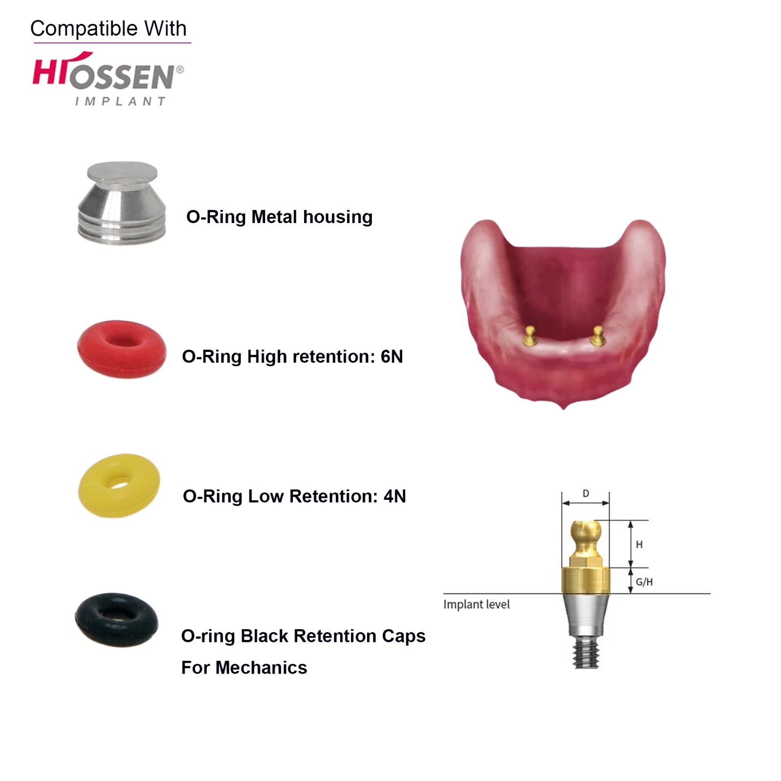 Dental Implant O-ring Retention Cap Kit For Hiossen/Osstem Ball Abutment 4pc/set
