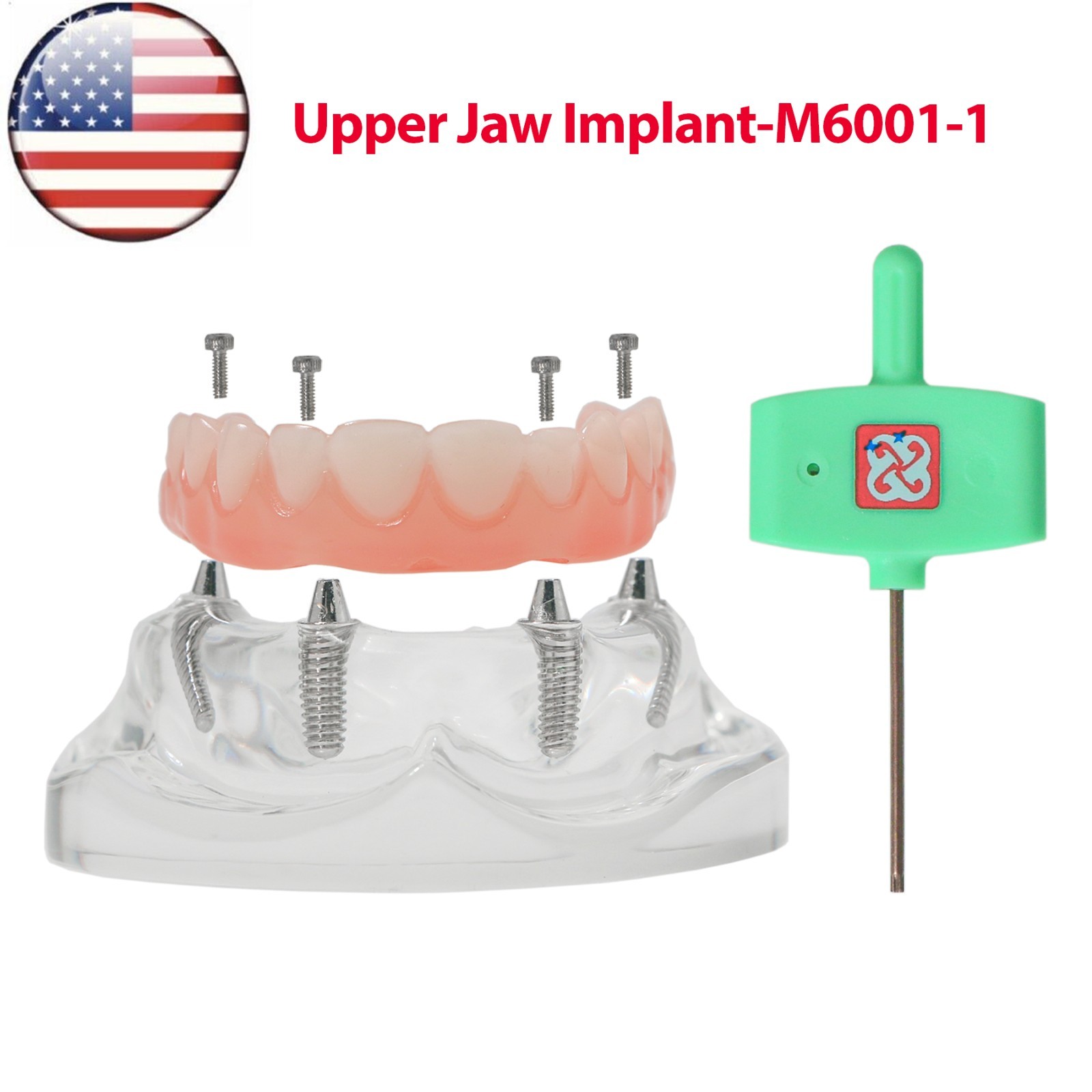 US Dental Upper/Lower Jaw All-on-4 Overdenture Implant Model with 4 Screws Clear