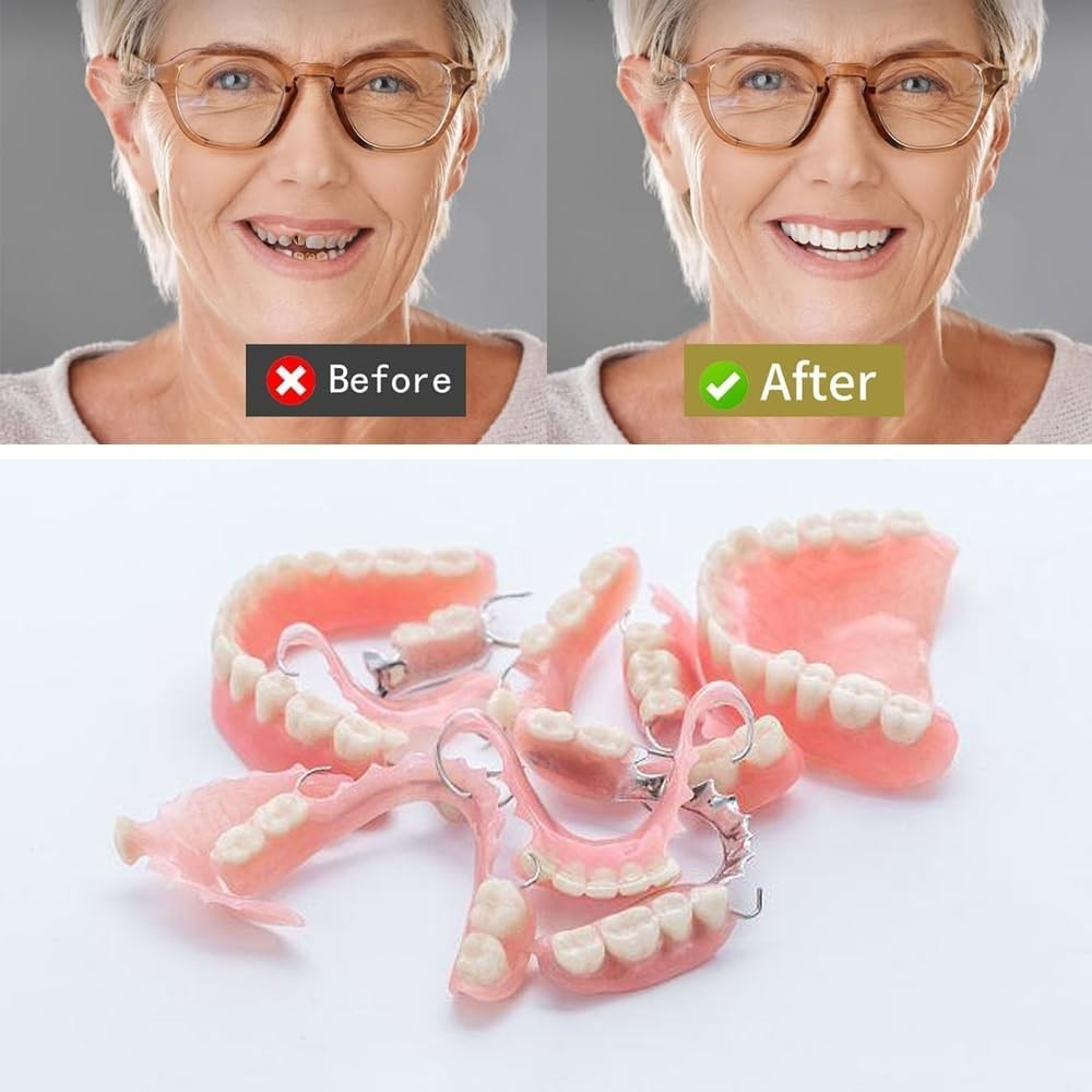 Quick Fix Gum Material for Missing Teeth – 22 Strips for Smile Enhancement