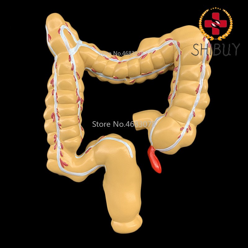 Colorectal Lesion Model Colon Large Intestine Pathological Model 14x17x21cm