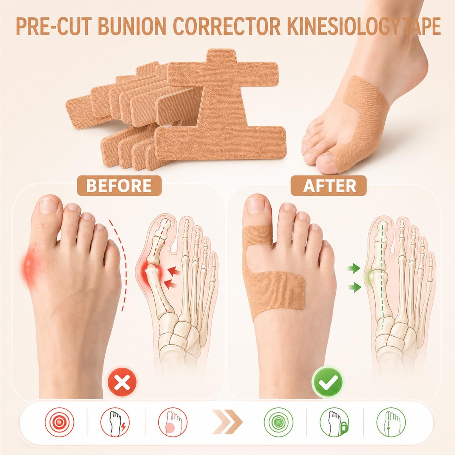 40 Pcs Pre-Cut Bunion Corrector Kinesiology Tape, Elastic 40 Pcs, Skin