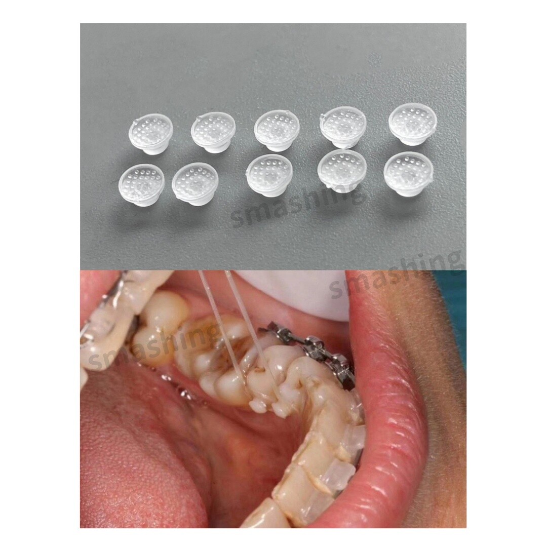 Dental Lingual Button Ceramic Clear Invisable Retainer Aligner Bondable Round