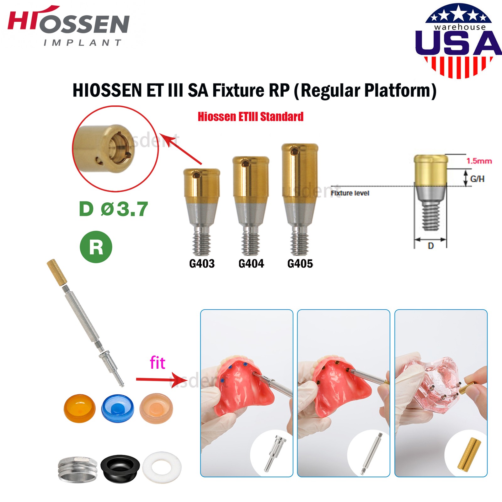 US Locator Tapered Overdenture Abutment Fit Hiossen/NobelActive /Zimmer/Adin/MIS