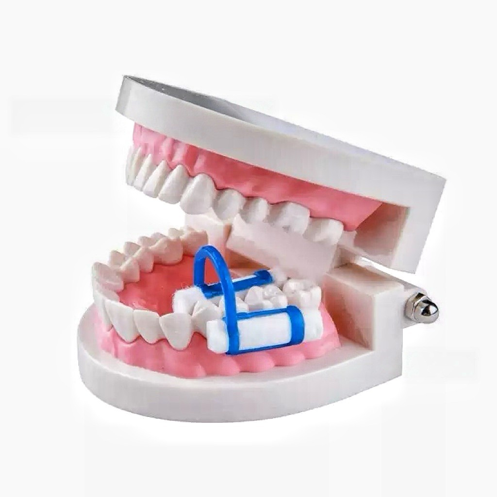 Disposable Cotton Roll Clip Bracket Helps Isolate Teeth (Blue) 50 Pieces –