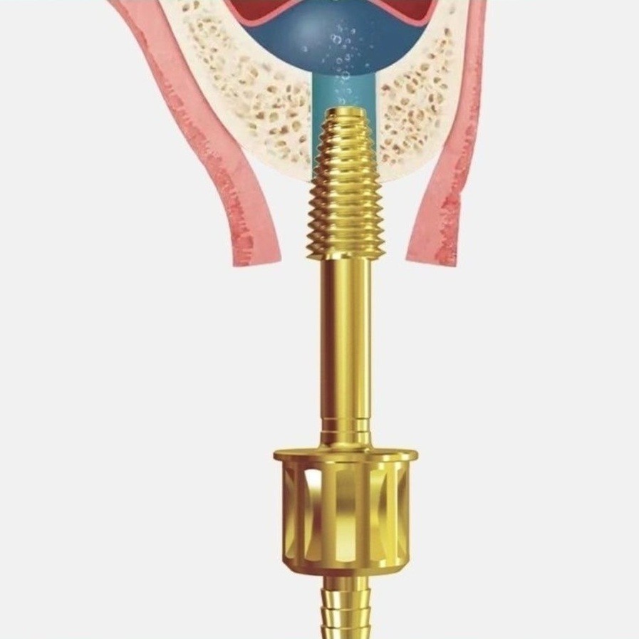 Dental Maxillary Lifter Sinus Lift Rising Hydraulic Lifter Aqua Tip Water Pipe