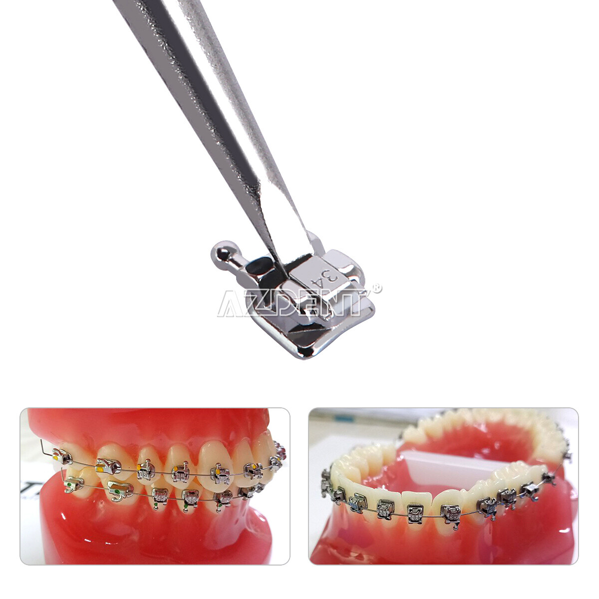 5X Brackets de Autoligado Ortodoncia Dental MBT 0.022 Ganchos 345 monobloque