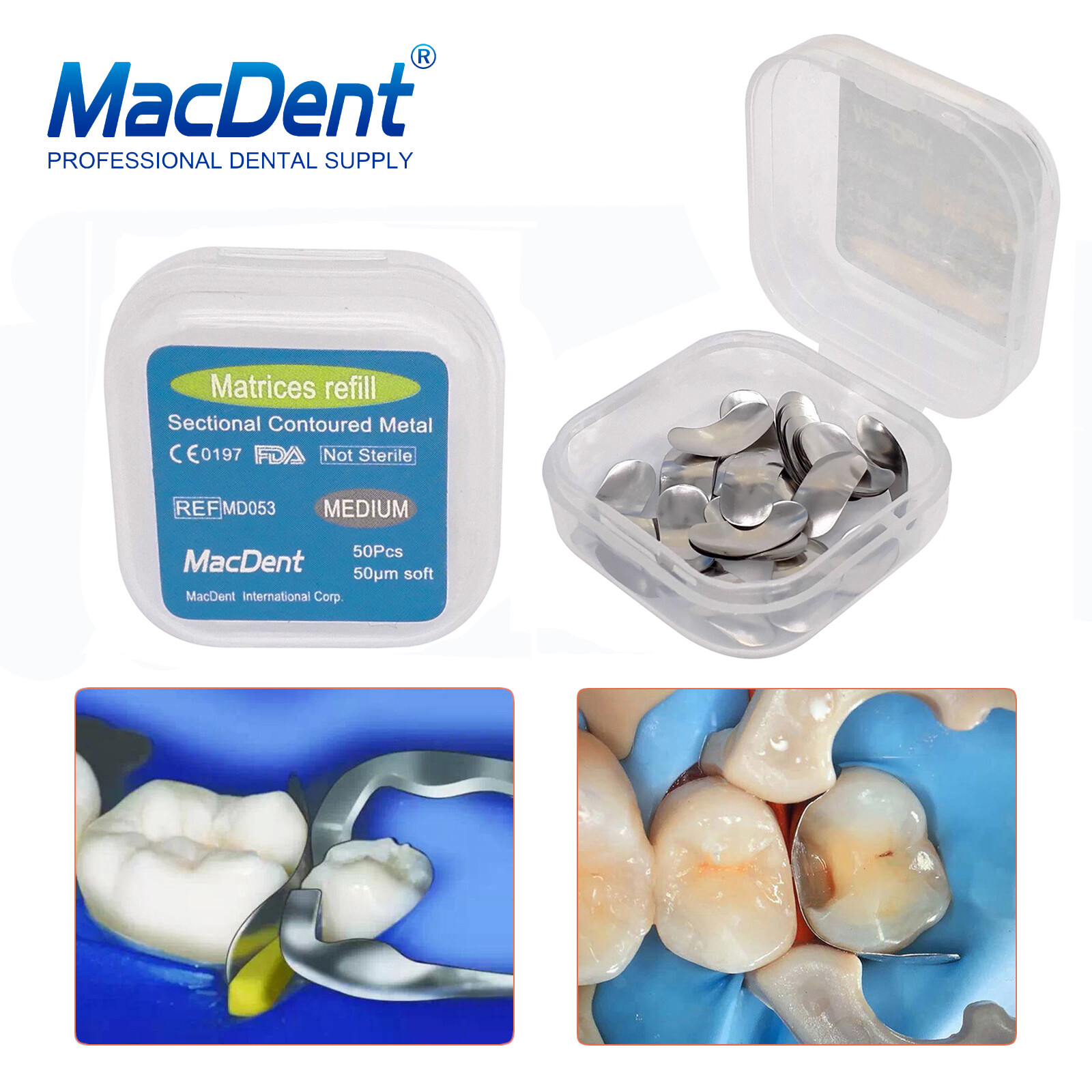 100×Dental Matrices Sectional Contoured Metal Soft Band Matrix Refill 50μm S/M/L