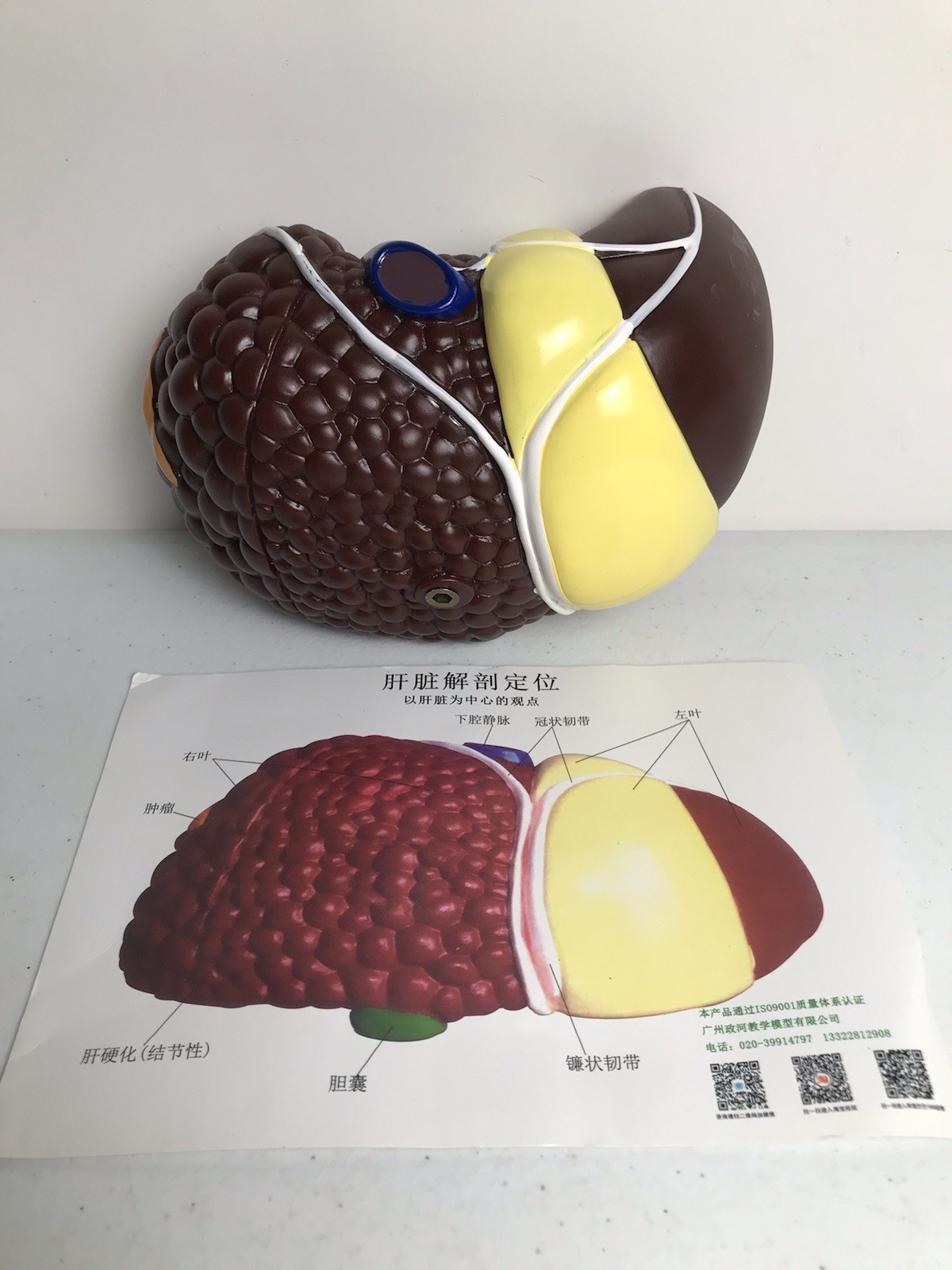 Pathological Liver Anatomical Model 1:1 Human Liver Model Anatomy Display Study